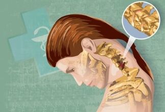 Symptoms reflexes of cervical osteochondrosis