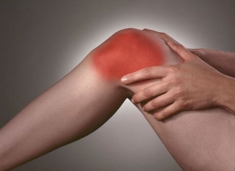 Knee articulation arthrosis